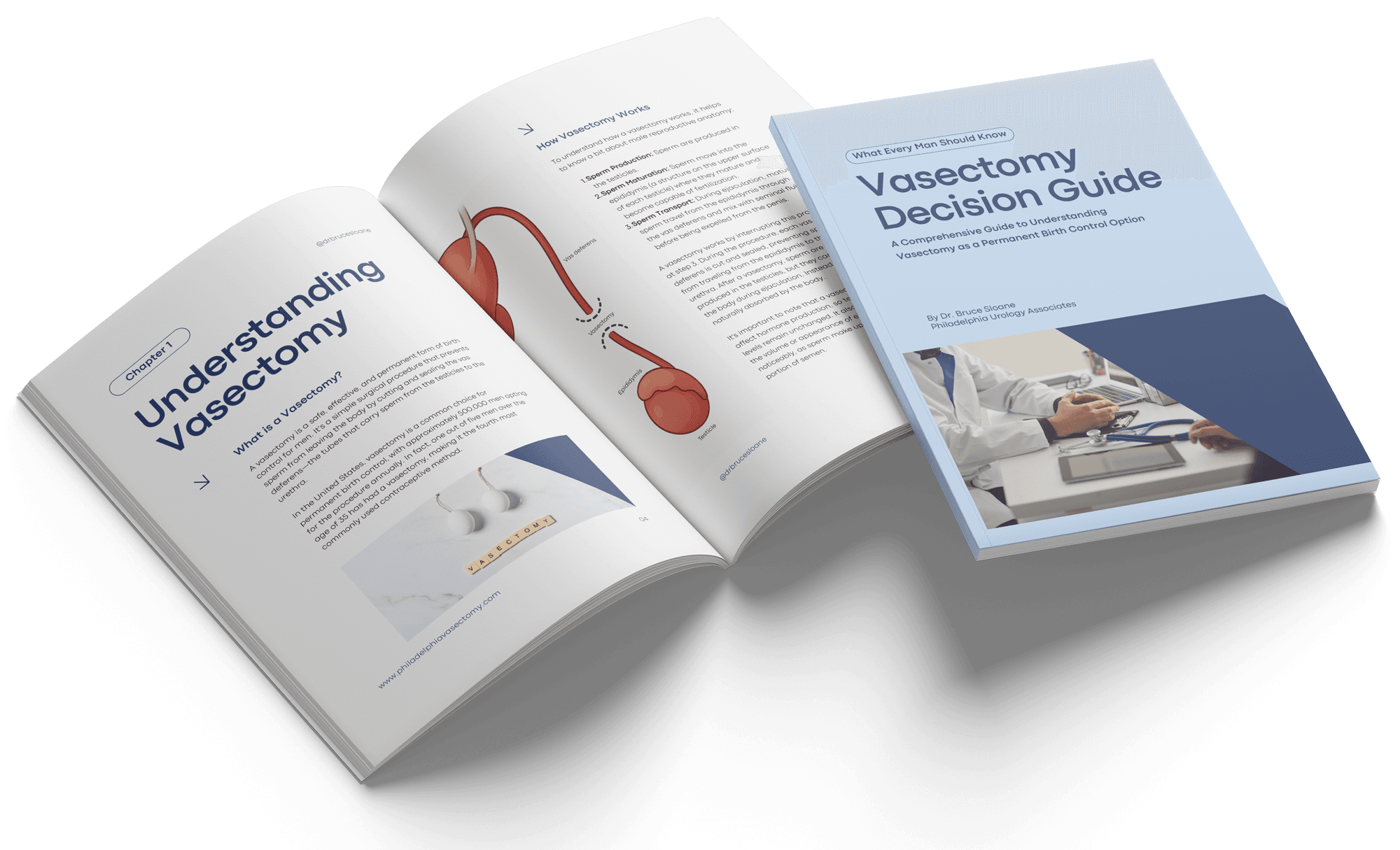 The Vasectomy Decision Guide